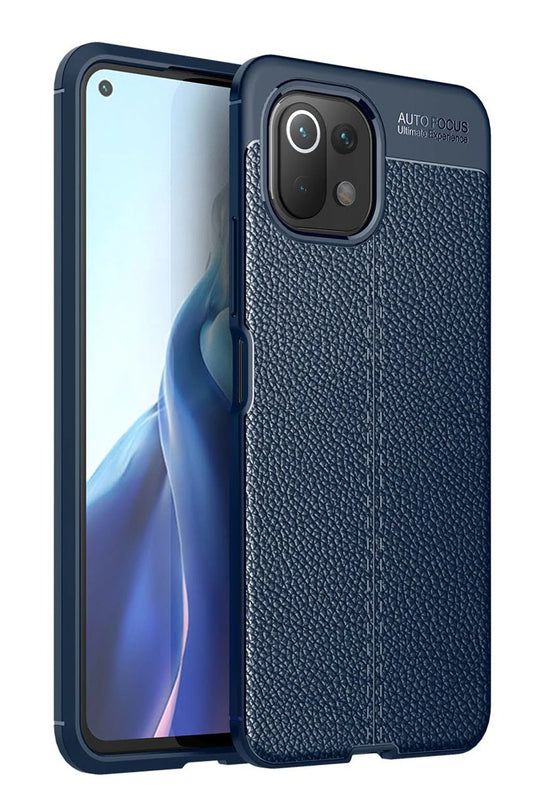 Xiaomi Mİ 11 Lite Auto Focus Kapak Kılıf - Lacivert