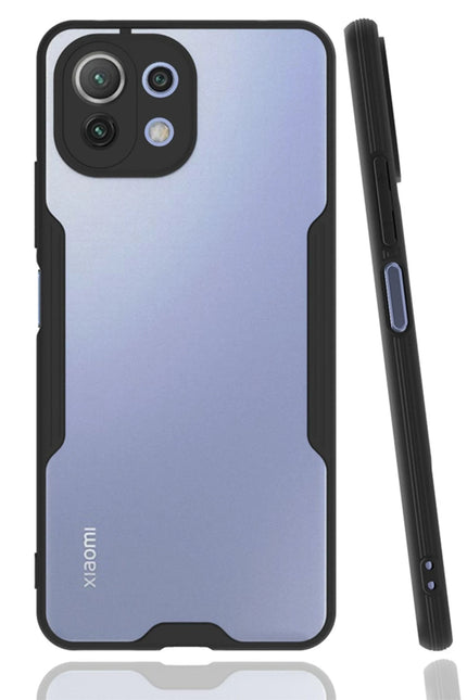 Xiaomi Mİ 11 Lite Platin Silikon Kılıf - Siyah