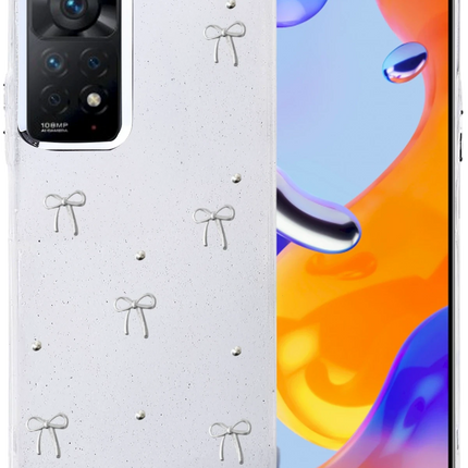Xiaomi Redmi Note 11 Pro Fiyonk Desenli Kapak Kılıf - Desen 5