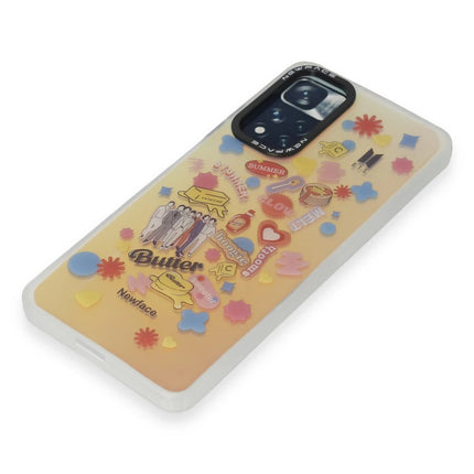 Xiaomi Redmi Note 11 Pro Estoril Desenli Kapak Kılıf - Desen 16 4