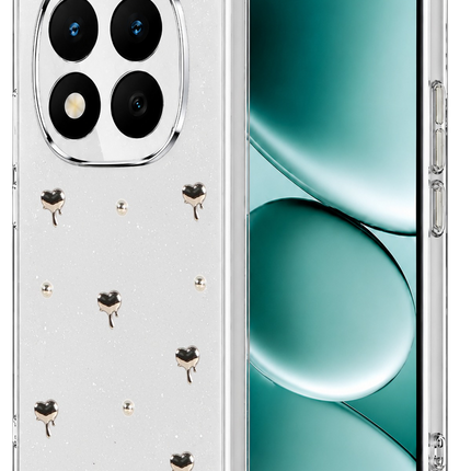 Xiaomi Redmi Note 15 4G Fiyonk Desenli Kapak Kılıf - Desen 1