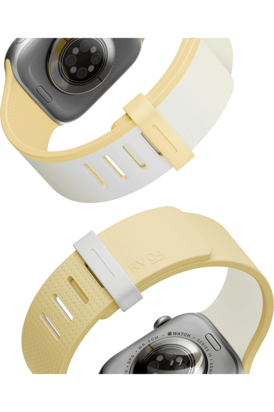 Watch 41mm Revix IV Reversible Manyetik Kordon - Sarı 3
