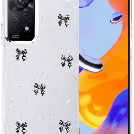 Xiaomi Redmi Note 11 Pro Fiyonk Desenli Kapak Kılıf - Desen 8
